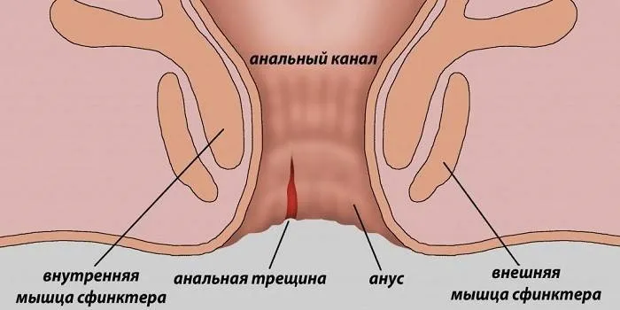 Hemoren : gdje kupiti u Hrvatskoj, u ljekarni?